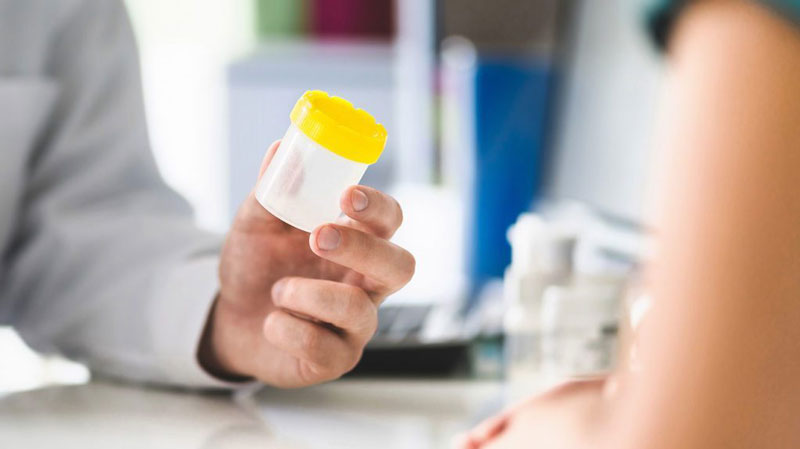 CBD Drogentests und Fahrtüchtigkeit